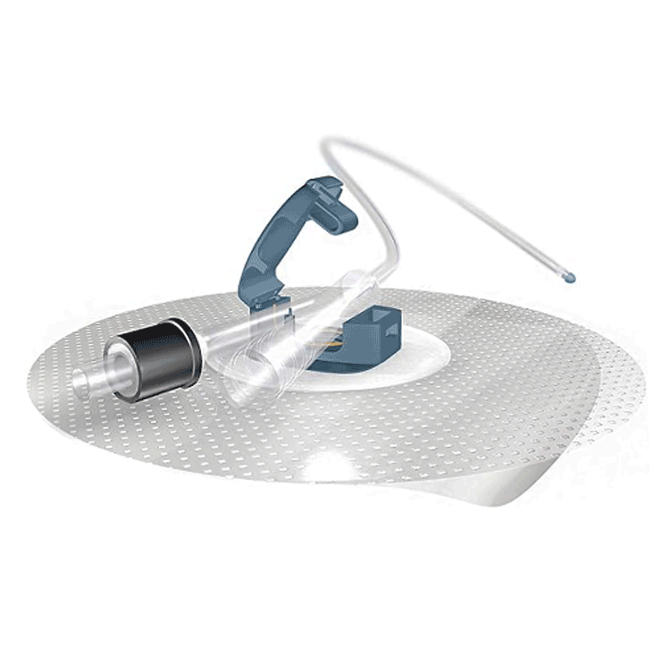 Urine Catheter Securement Kit - Ugofix Catheter Clip With or Without Urisleeve Leg Bag Holder x 4 units by Bard